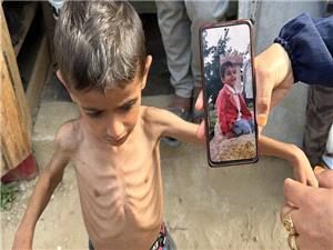 صهیونیست به صورت برنامهریزی شده در حال نابود کردن نسل آینده غزه است